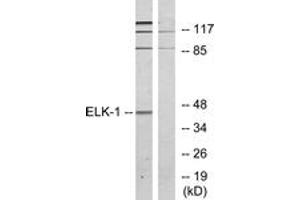 Western blot analysis of extracts from HeLa cells, treated with heat shock, using Elk1 (Ab-389) Antibody.