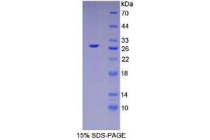 SDS-PAGE analysis of Human HNF4a Protein. (HNF4A Protein)