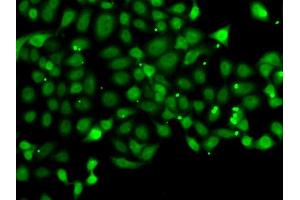 Immunofluorescence analysis of MCF7 cell using PDCD5 antibody. (PDCD5 Antikörper)