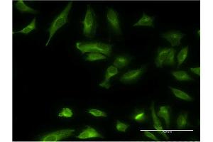 Immunofluorescence of monoclonal antibody to ETNK1 on HeLa cell. (Ethanolamine Kinase 1 Antikörper  (AA 133-228))