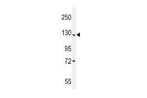 DDX60L Antibody (C-term) (ABIN655540 and ABIN2845051) western blot analysis in NCI- cell line lysates (35 μg/lane). (DDX60L Antikörper  (C-Term))