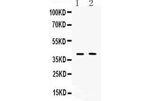 Western blot analysis of Islet 1 expression in PC12 whole cell lysates ( Lane 1) and MCF-7 whole cell lysates ( Lane 2). (ISL1 Antikörper  (Middle Region))