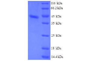 SDS-PAGE (SDS) image for Serum Amyloid A (SAA) (AA 19-129) protein (His-GST) (ABIN5710308)