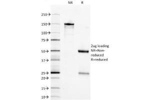 SDS-PAGE Analysis of Purified, BSA-Free NSE Antibody (clone ENO2/1375).
