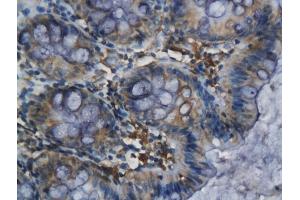Immunohistochemistry (IHC) image for anti-ELAV (Embryonic Lethal, Abnormal Vision, Drosophila)-Like 1 (Hu Antigen R) (ELAVL1) antibody (ABIN748583)