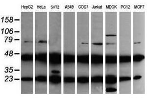 Image no. 2 for anti-Mitogen-Activated Protein Kinase Kinase 1 (MAP2K1) antibody (ABIN1499377) (MEK1 Antikörper)