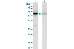 Western Blot analysis of CBS expression in transfected 293T cell line by CBS monoclonal antibody (M02), clone 3D10. (CBS Antikörper  (AA 1-100))
