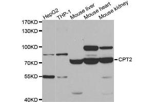 Western blot analysis of extracts of various cell lines, using CPT2 antibody. (CPT2 Antikörper)