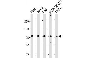 All lanes : Anti-NLRP3 Antibody (N-term) at 1:1000-1:2000 dilution Lane 1: Hela whole cell lysate Lane 2: Jurkat whole cell lysate Lane 3: Raji whole cell lysate Lane 4: MDA-MB-231 whole cell lysate Lane 5: THP-1 whole cell lysate Lysates/proteins at 20 μg per lane.