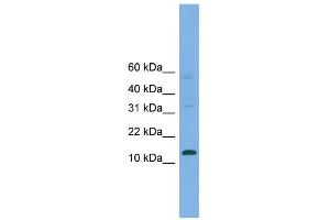 WB Suggested Anti-CRABP2 Antibody Titration:  0. (CRABP2 Antikörper  (Middle Region))