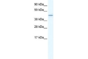 WB Suggested Anti-TMEM108 Antibody Titration:  1. (TMEM108 Antikörper  (Middle Region))