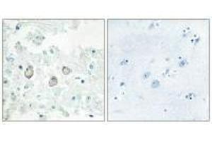 Immunohistochemistry analysis of paraffin-embedded human brain tissue using DOK7 antibody. (DOK7 Antikörper  (N-Term))