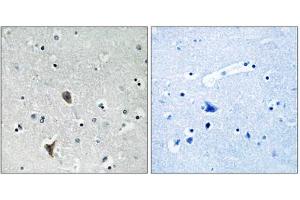Immunohistochemistry analysis of paraffin-embedded human brain tissue using OXR1 antibody. (OXR1 Antikörper  (Internal Region))