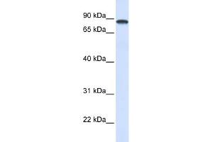 WB Suggested Anti-DDX1 Antibody Titration:  0. (DDX1 Antikörper  (Middle Region))