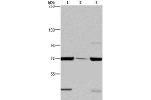 Western Blot analysis of LoVo cell, Human testis tissue and A549 cell using FAAH Polyclonal Antibody at dilution of 1:400 (FAAH Antikörper)