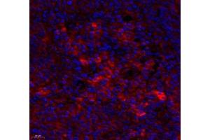 Immunofluorescence of paraffin embedded human tonsil using MS4A2 (ABIN7074594) at dilution of 1: 400 (400x lens) (MS4A2 Antikörper)