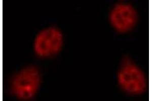 ABIN6269286 staining HepG2 by IF/ICC.