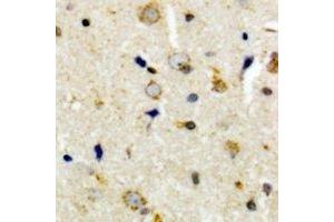 Immunohistochemical analysis of CEP135 staining in human brain formalin fixed paraffin embedded tissue section. (CEP135 Antikörper  (C-Term))