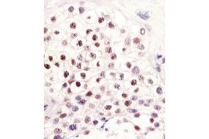Antibody staining LIN28B in human testis tissue sections by Immunohistochemistry (IHC-P - paraformaldehyde-fixed, paraffin-embedded sections). (LIN28B Antikörper  (AA 95-128))