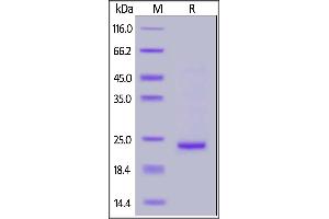 SARS-CoV-2 NSP8, His Tag on SDS-PAGE under reducing (R) condition. (SARS-Coronavirus Nonstructural Protein 8 (SARS-CoV NSP8) protein (His tag))