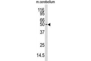 Western Blotting (WB) image for anti-Calcium/calmodulin-Dependent Protein Kinase Kinase 1, alpha (CAMKK1) antibody (ABIN3003479) (CAMKK1 Antikörper)