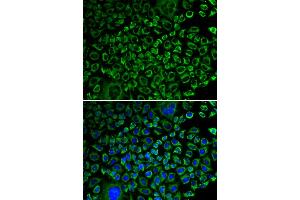 Immunofluorescence analysis of A549 cells using F10 antibody. (Coagulation Factor X Antikörper)