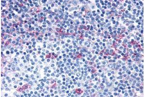 Anti-CCR7 antibody  ABIN1048400 IHC staining of human lymph node. (CCR7 Antikörper  (C-Term))