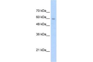 Western Blotting (WB) image for anti-Solute Carrier Family 22 (Organic Cation Transporter), Member 1 (SLC22A1) antibody (ABIN2462426) (SLC22A1 Antikörper)
