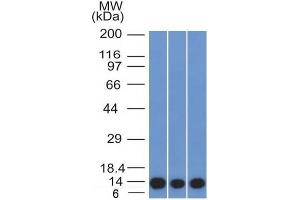 Western Blot of HeLa, A549 and A375 cell lysates using S100A4 Mouse Monoclonal Antibody (S100A4/1481). (s100a4 Antikörper  (AA 1-200))