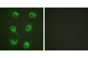 Peptide - +Immunofluorescence analysis of HuvEc cells, using CrkL (Ab-207) antibody (#B0067). (CrkL Antikörper  (Tyr207))