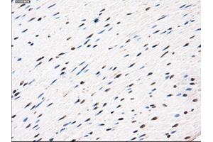 Immunohistochemical staining of paraffin-embedded Ovary tissue using anti-AKR1A1mouse monoclonal antibody. (AKR1A1 Antikörper)