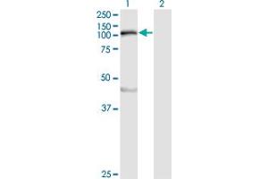 Western Blot analysis of MYLK expression in transfected 293T cell line by MYLK monoclonal antibody (M01), clone 1D1.