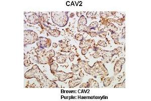 Sample Type :  Human placental tissue   Primary Antibody Dilution :   1:50  Secondary Antibody :  Goat anti rabbit-HRP   Secondary Antibody Dilution :   1:10,000  Color/Signal Descriptions :  Brown: CAV2 Purple: Haemotoxylin  Gene Name :  CAV2  Submitted by :  Dr. (Caveolin 2 Antikörper  (N-Term))
