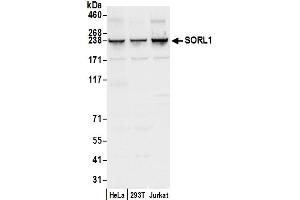 Western Blotting (WB) image for anti-Sortilin-Related Receptor, L(DLR Class) A Repeats Containing (SORL1) (AA 2164-2214) antibody (ABIN7453208)