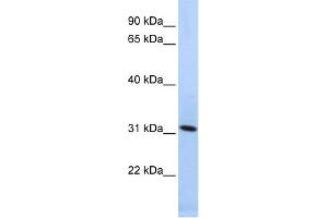 WB Suggested Anti-SYNGR4 Antibody Titration:  0. (SYNGR4 Antikörper  (N-Term))