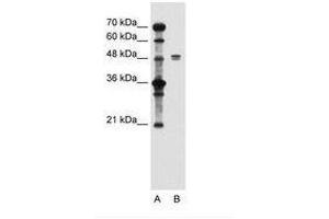 Image no. 2 for anti-Solute Carrier Family 39 (Zinc Transporter), Member 6 (SLC39A6) (AA 26-75) antibody (ABIN205014) (SLC39A6 Antikörper  (AA 26-75))