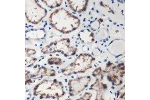 Immunohistochemical analysis of DMGDH staining in human kidney formalin fixed paraffin embedded tissue section. (DMGDH Antikörper  (C-Term))