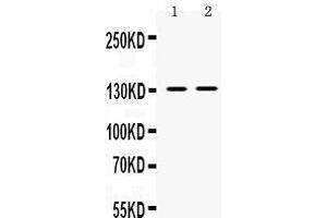 Western blot analysis of TRPM5 expression in SMMC whole cell lysates (lane 1) and 293T whole cell lysates (lane 2). (TRPM5 Antikörper  (AA 1021-1108))