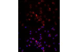 Immunofluorescence analysis of THP-1 cells using CXCL12 antibody (ABIN6130152, ABIN6139271, ABIN6139272 and ABIN6217180) at dilution of 1:200. (CXCL12 Antikörper  (AA 22-89))