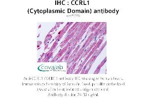 Image no. 2 for anti-Chemokine (C-C Motif) Receptor-Like 1 (CCRL1) (2nd Cytoplasmic Domain) antibody (ABIN1732791) (CCRL1 Antikörper  (2nd Cytoplasmic Domain))
