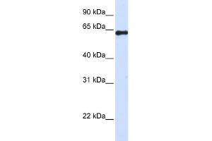 WB Suggested Anti-FAM116A Antibody Titration: 0. (FAM116A Antikörper  (Middle Region))