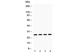 Western blot testing of 1) rat brain, 2) mouse ovary, 3) human 22RV1 and 4) human HeLa lysate with HMGB1 antibody at 0. (HMGB1 Antikörper  (AA 124-154))