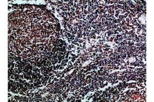 Immunohistochemical analysis of paraffin-embedded Human-tonsil, antibody was diluted at 1:100 (HLA-DMB Antikörper  (AA 40-100))