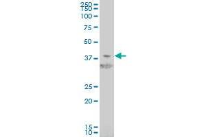 HIF1AN monoclonal antibody (M01), clone 1D8 Western Blot analysis of HIF1AN expression in Jurkat . (HIF1AN Antikörper  (AA 1-349))