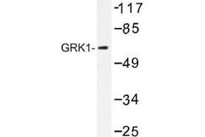 Image no. 1 for anti-G Protein-Coupled Receptor Kinase 1 (GRK1) antibody (ABIN317886) (GRK1 Antikörper)