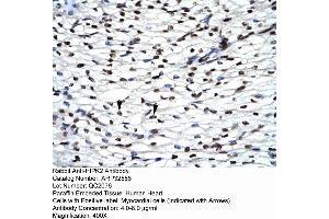 Rabbit Anti-HIPK2 Antibody  Paraffin Embedded Tissue: Human Heart Cellular Data: Myocardial cells Antibody Concentration: 4. (HIPK2 Antikörper  (Middle Region))