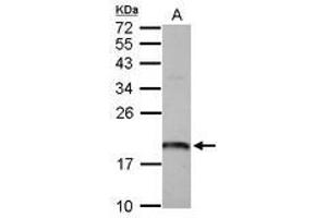 Image no. 1 for anti-ADP Ribosylation Factor Like GTPase 1 (ARL1) (AA 1-163) antibody (ABIN1496712) (ARL1 Antikörper  (AA 1-163))