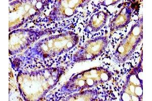Immunohistochemistry of paraffin-embedded human small intestine tissue using ABIN7153569 at dilution of 1:100 (TUBGCP4 Antikörper  (AA 203-309))
