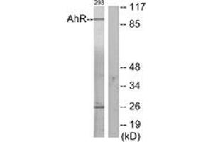 Western blot analysis of extracts from 293 cells, using AhR (Ab-36) Antibody. (Aryl Hydrocarbon Receptor Antikörper  (AA 2-51))