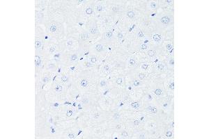 Immunohistochemistry of paraffin-embedded Human liver (negative control sample) using [KO Validated] p53 Rabbit mAb (ABIN7271080) at dilution of 1:100 (40x lens). (p53 Antikörper)